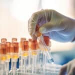 lab assistant holding test tubes